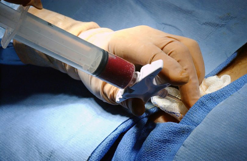 Bone marrow in syringe