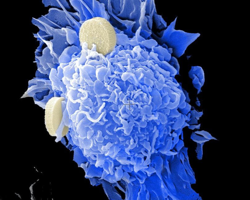 Laboratory scan of a cancer cell