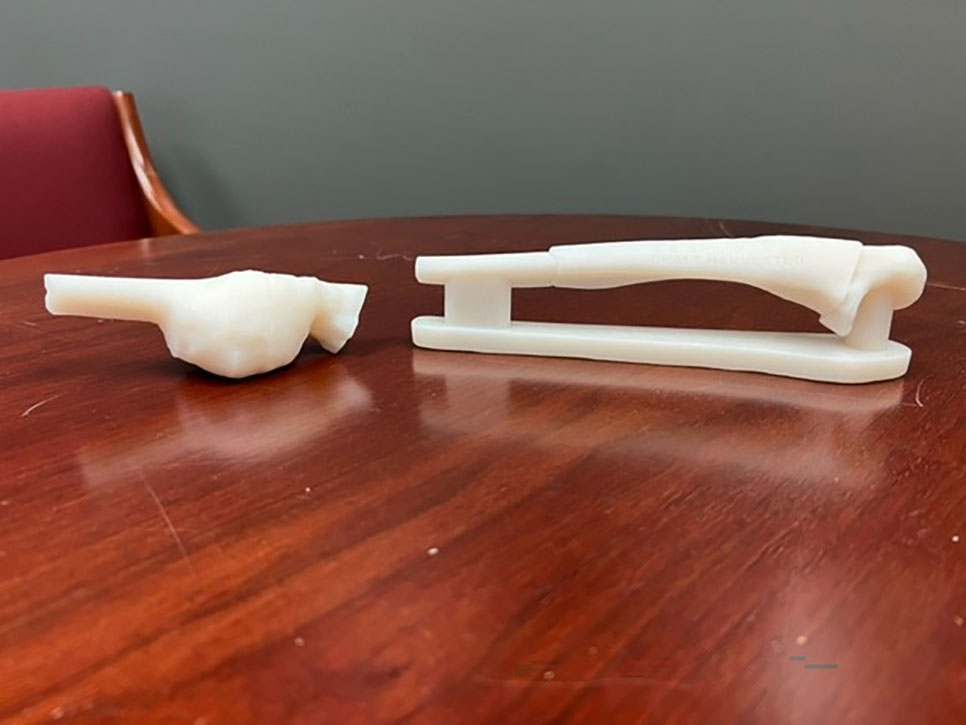 3D model of bone